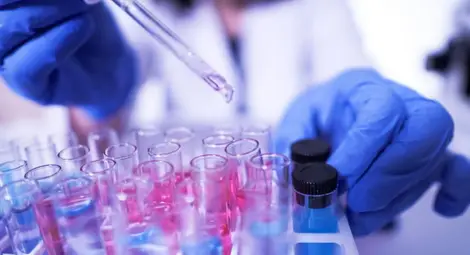 Нефролог: Преболедувалите COVID-19 да си направят изследване на урината