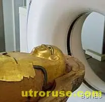 И в древността страдали от атеросклероза 