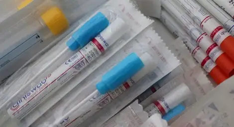 17 000 фалшиви теста за COVID-19 са иззети при операция на Интерпол