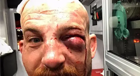 Победител в ММА бой напусна ринга като след кланица Победител в ММА бой напусна ринга като след кланица