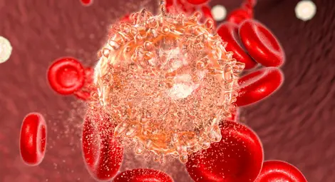 Учени използват наночастици за лечение на левкемия Учени използват наночастици за лечение на левкемия