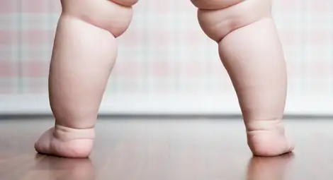 Около 150 000 деца в България страдат от затлъстяване