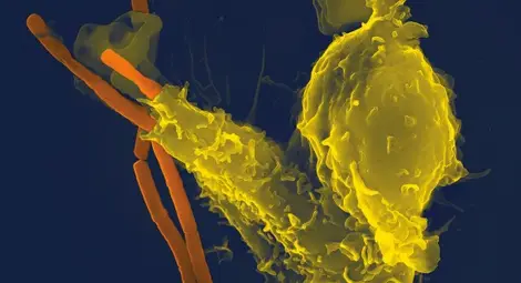 ЗАЩО Е ТОЛКОВА ТРУДНО НА ИМУННАТА СИСТЕМА ДА СЕ СПРАВИ С КОРОНАВИРУС ЗАЩО Е ТОЛКОВА ТРУДНО НА ИМУННАТА СИСТЕМА ДА СЕ СПРАВИ С КОРОНАВИРУС