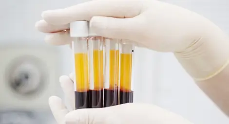 Даряването на кръвна плазма - добри и лоши новини