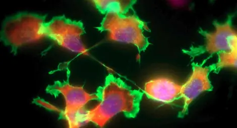 Учени откриха молекула, задействаща клетки убийци на раковия тумор