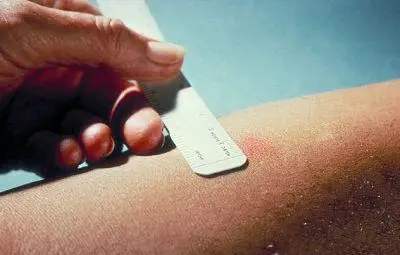 Пре&shy;мах&shy;ват прег&shy;ле&shy;да за ман&shy;ту