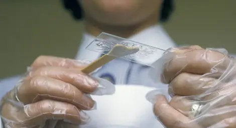 Трябва да бъде намалено прекомерното приложение на скрининговите изследвания за рак на маточната шийка Трябва да бъде намалено прекомерното приложение на скрининговите изследвания за рак на маточната шийка