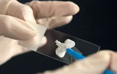 Без паника, ако носите HPV вирус 