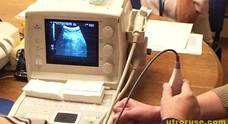 Изследват срещу 10 лева костната плътност в Трета поликлиника