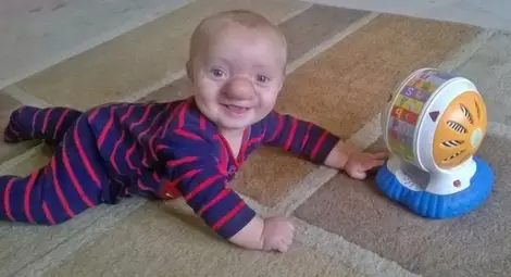 Истинският Буратино пребори мъчителна болест с усмивка /галерия/