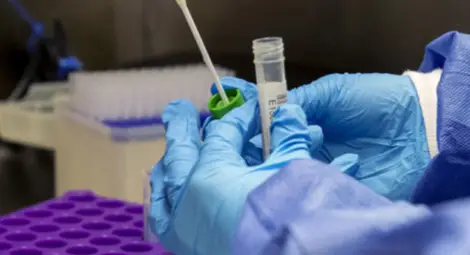 6252 новозаразени с Ковид-19 за денонощие, рекордните 256 случая в Русе и областта