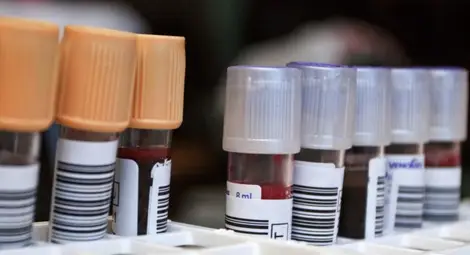 Момиче, родило се без капка кръв, тръгна на училище