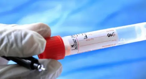 В малките магазини в Берлин влизат само с отрицателен PCR