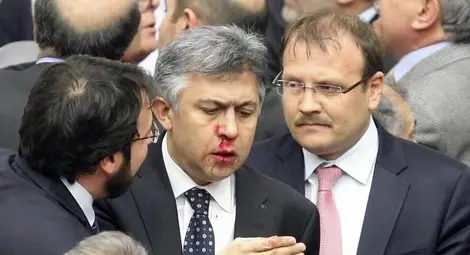 Масов бой в турския парламент, един със счупен нос