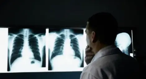 Уникален наночип открива рака на пушачите