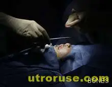 Пластичен хирург остави пациент без нос