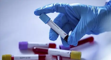 Два пъти повече заразени с Ковид-19 за седмица Два пъти повече заразени с Ковид-19 за седмица