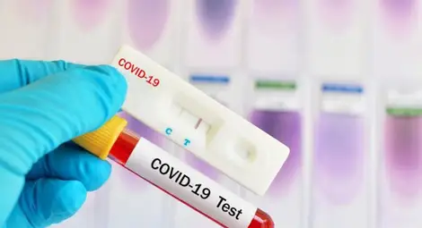 98 нови случаи на COVID-19 в Русе