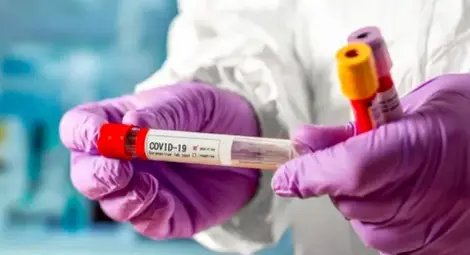 1713 новозаразени с коронавирус за денонощието, с 20 по-малко от вчера. 7,3% от тестваните