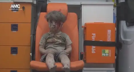 Момчето, станало символ на войната в Сирия, се появи отново в публичното пространство