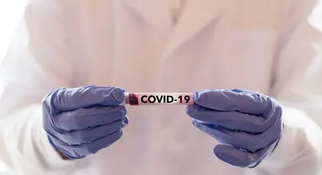 203-ма новозаразени с коронавирус у нас, 9 починали