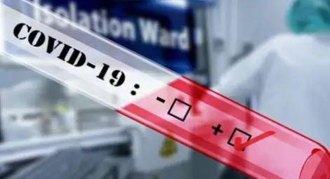 Нови два случая на Ковид-19 за последното денонощие в Русе