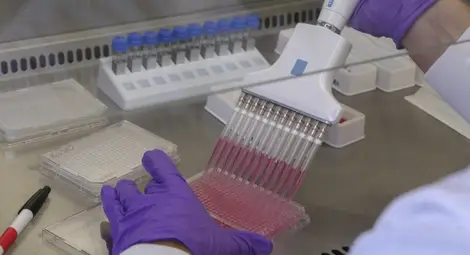 Испанска медицинска сестра е първият пациент, заразен с ебола в Европа Испанска медицинска сестра е първият пациент, заразен с ебола в Европа