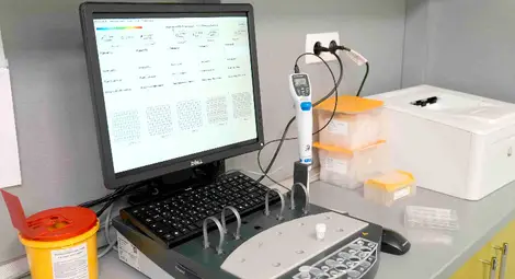 Най-ново поколение апаратура за изследване на тромбоцитната агрегация заработи в Клиничната лаборатория на МЕДИКА