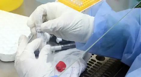 Вижте списъка: В кои болници и лаборатории правят безплатни антигенни тестове