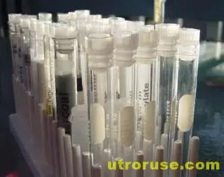 Бебе с вируса на СПИН беше обявено за излекувано