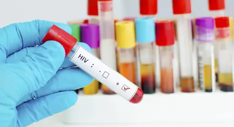 Забележителен пробив в лечението на СПИН