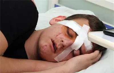 Ужас в Пловдив: Фенове на "Локомотив" смазаха от бой сина на журналистка