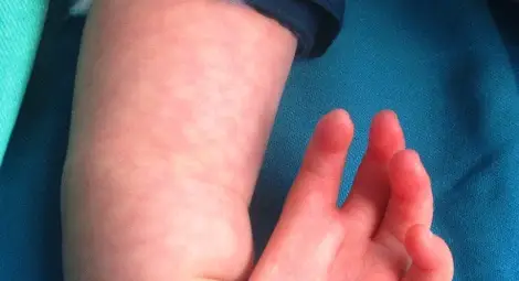 Преди операцията