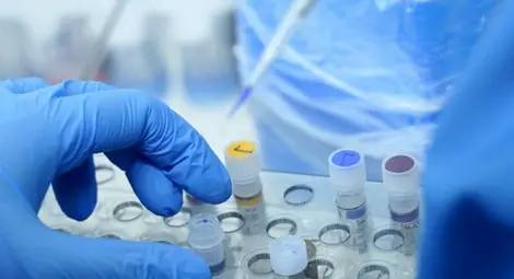 Занзибар въвежда задължително онлайн регистрация за COVID тестове Занзибар въвежда задължително онлайн регистрация за COVID тестове