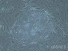 Лъч надежда: Нов препарат кара раковите клетки да се самоизяждат