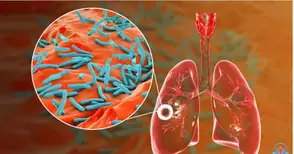 Две седмици безплатен скрининг за туберкулоза в Белодробната болница