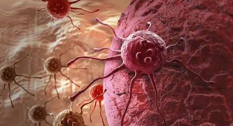 Заплашено ли е младото поколение от бум на рака