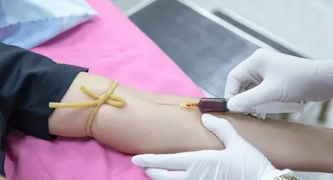 Връзка между рака на простатата и дефицита на витамин D откриха учени