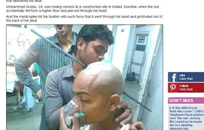 Лекари извадиха двуметров прът от главата на строителен работник