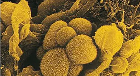 Кога откритията срещу рак ще започнат да помагат?