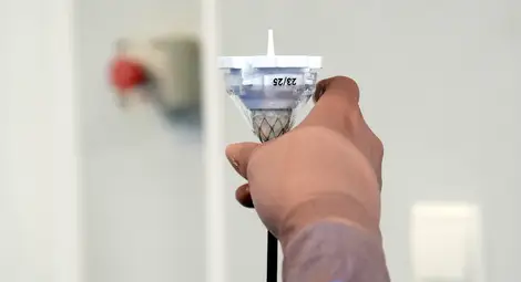 В Сърдечно-съдовия център на МЕДИКА вече сменят аортни клапи през бедрената артерия