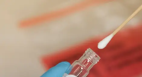 Лабораторията за изследване на Ковид в болница &bdquo;Канев&ldquo; прави 4 вида тестов