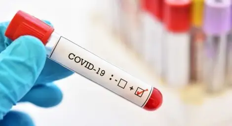 Скок на заразените с COVID-19, новите случаи гонят 200