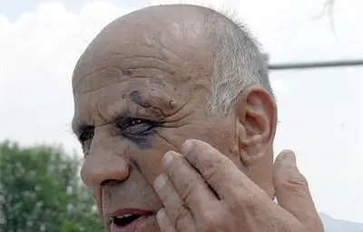 Пребиха с дърво кмет след спор за миризлив обор Пребиха с дърво кмет след спор за миризлив обор