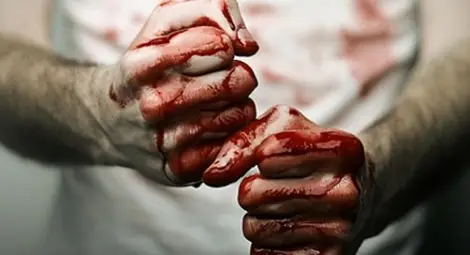 Нападнат от питбул пребит от стопанина, защото се защитавал