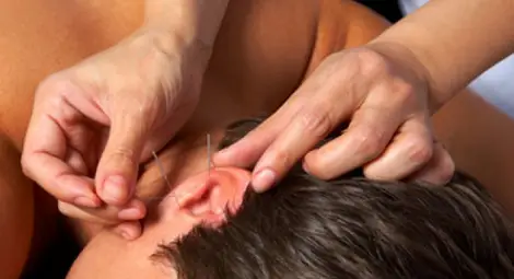 Акупунктура на ухото подпомага отслабването