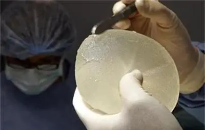 Регистрираха случаи на нов вид рак във Франция, свързан е с гръдните импланти Регистрираха случаи на нов вид рак във Франция, свързан е с гръдните импланти