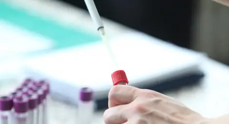 63 нови заразени с COVID-19 у нас 63 нови заразени с COVID-19 у нас