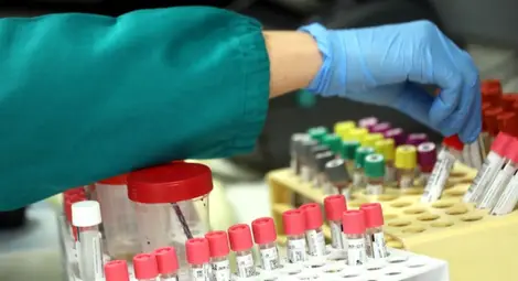 Франция тества успешно лекарство срещу коронавирус