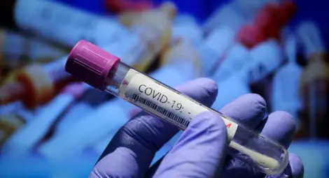 Над 180 журналисти по света &ndash; жертва на COVID-19